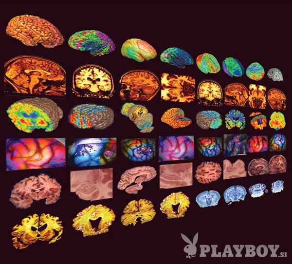 Prostorska možganska kartografija: obstaja vrsta metod za predstavitev zgradbe in funkcije možganskih struktur na različnih ravneh. (foto: *)