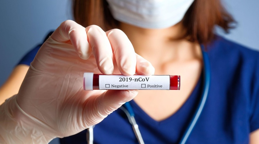 Kitajski znanstveniki izolirali novi koronavirus (foto: profimedia)