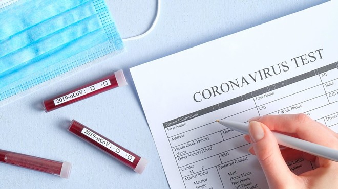 Rusija in Kitajska razvijata cepivo, v Avstraliji vzgojili nov koronavirus (foto: profimedia)