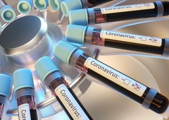 Interaktivni e-zemljevid, ki V ŽIVO spremlja širjenje koronavirusa po svetu!