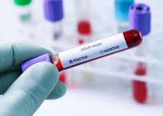 Koronavirus: zaradi okuženih v Italiji na MZZ svetujejo previdnost