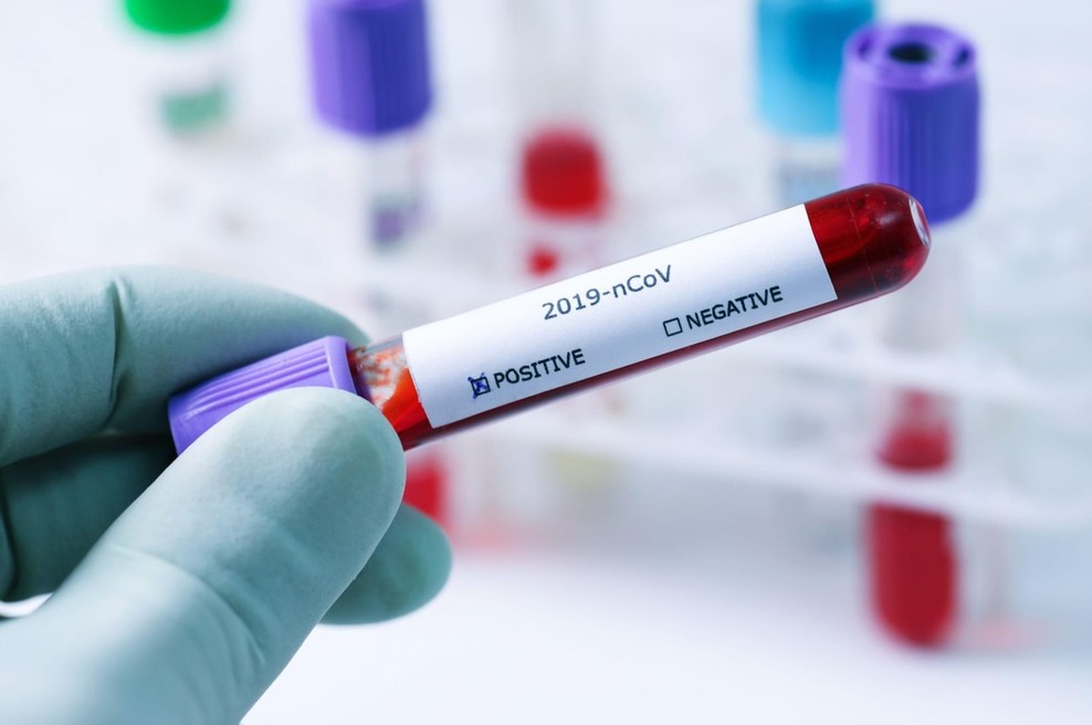 Koronavirus: zaradi okuženih v Italiji na MZZ svetujejo previdnost (foto: profimedia)