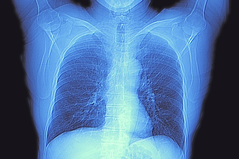 Njujorškim zdravnikom uspel preboj v diagnostiki okužbe z novim koronavirusom (foto: profimedia)