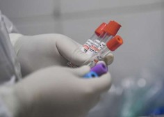 Število okuženih z novim koronavirusom v Sloveniji naraslo na šest