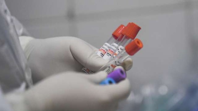 Število okuženih z novim koronavirusom v Sloveniji naraslo na šest (foto: Xinhua/STA)