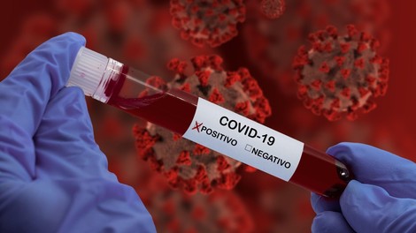 Zakaj zdravniki ne paničarijo (več), ko gre za novi koronavirus?