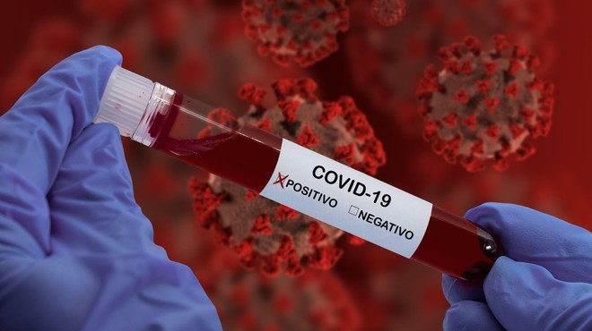 Zakaj zdravniki ne paničarijo (več), ko gre za novi koronavirus? (foto: profimedia)