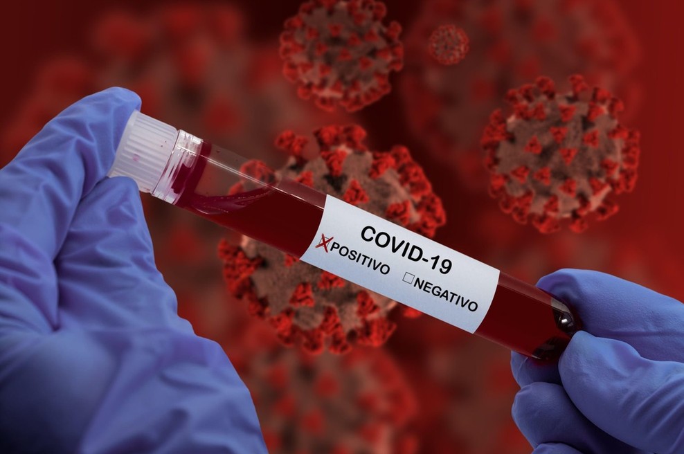 Zakaj zdravniki ne paničarijo (več), ko gre za novi koronavirus? (foto: profimedia)