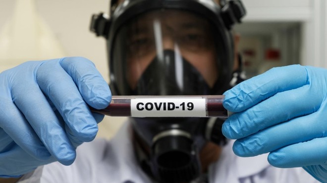 Število okužb z novim koronavirusom v Sloveniji naraslo na 12 (foto: profimedia)