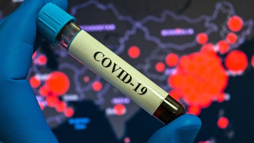 Avstralski znanstveniki ugotovili, kako se imunski sistem odziva na koronavirus
