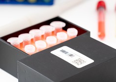 Testi za novi koronavirus iz Kitajske tudi za Slovenijo