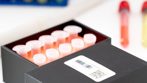 Testi za novi koronavirus iz Kitajske tudi za Slovenijo