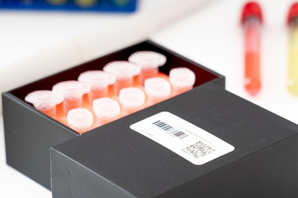 Testi za novi koronavirus iz Kitajske tudi za Slovenijo (foto: profimedia)