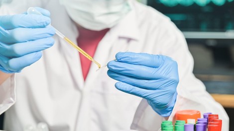 Statistične številke znova navzgor: 730 okuženih, 11 umrlih