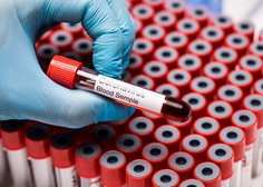V Sloveniji v torek 39 novih primerov okužbe s koronavirusom
