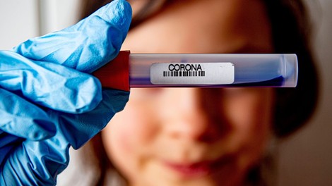 V Rusiji pričeli s proizvodnjo novih testov za COVID-19