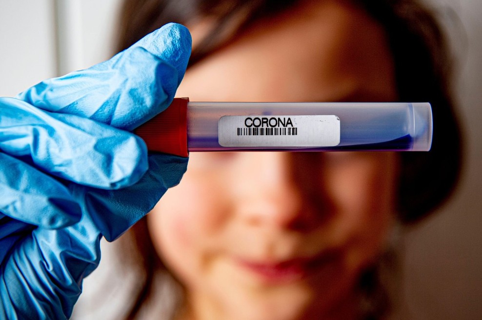 V Rusiji pričeli s proizvodnjo novih testov za COVID-19 (foto: profimedia)