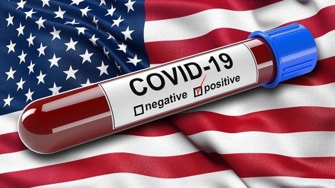 Trump zanika, da bi imeli v ZDA problem s pomanjkanjem testov