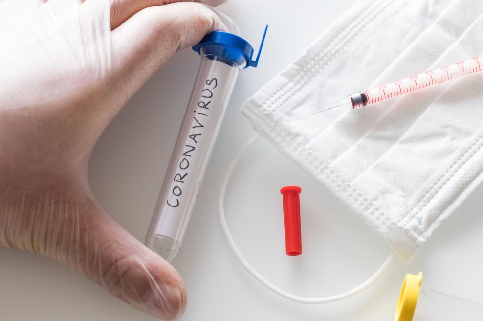 Obetavno japonsko zdravilo za koronavirus že v Sloveniji (foto: Profimedia)