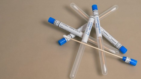 Slovenska statistika: še 36 okuženih in pet umrlih