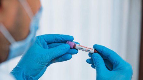 Statistika v Sloveniji: 9 novih okužb, brez novih smrtnih žrtev
