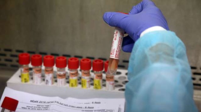 Zdravilo proti malariji hidroksiklorokin ni uspešno proti koronavirusu (foto: Xinhua/STA)