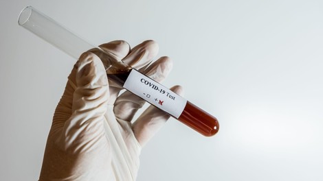 WHO opozarja: Koronavirus bo še dolgo prisoten
