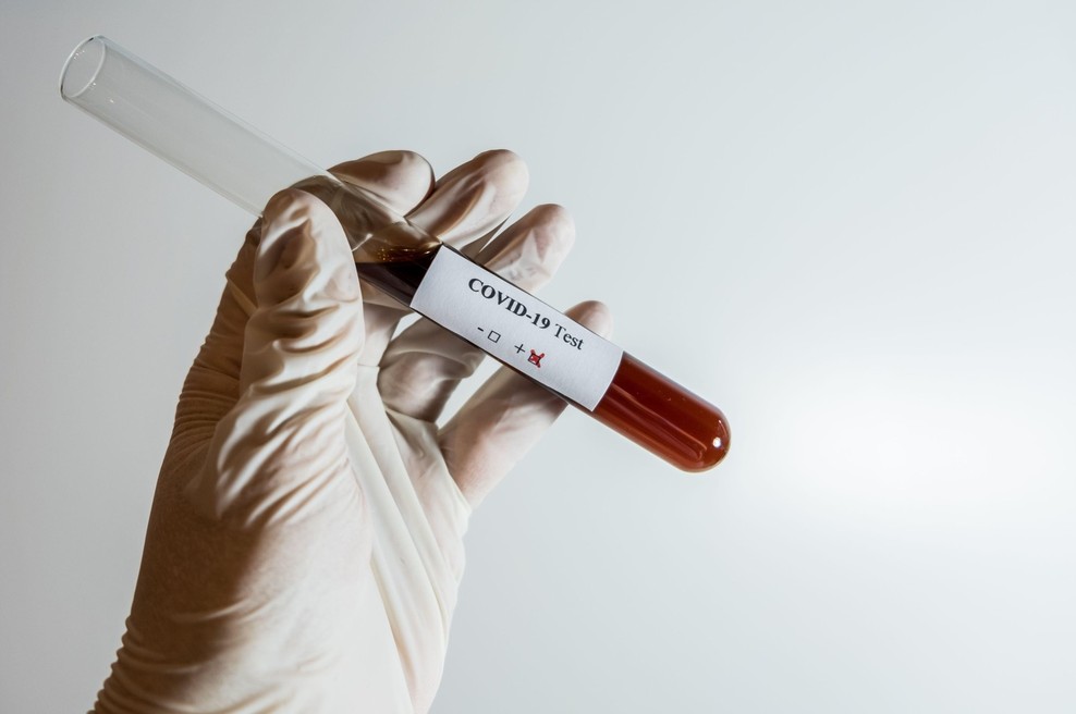 WHO opozarja: Koronavirus bo še dolgo prisoten (foto: Profimedia)