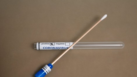 V petek se je v Sloveniji okuženim pridružilo še 15 oseb, zabeležili še enega umrlega