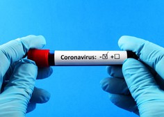 V raziskavi o razširjenosti koronavirusa odkrili aktivni primer okužbe