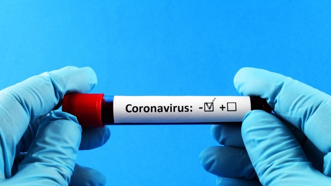 V raziskavi o razširjenosti koronavirusa odkrili aktivni primer okužbe (foto: profimedia)