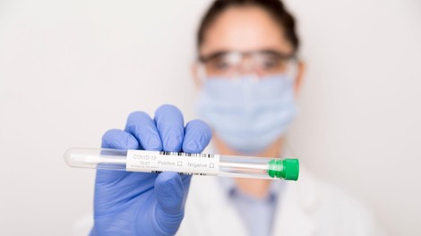 Statistika v Sloveniji: 10 potrjenih okužb, tri nove smrti
