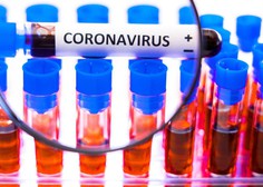 V raziskavi o razširjenosti koronavirusa pri nas so odvzeli vse vzorce