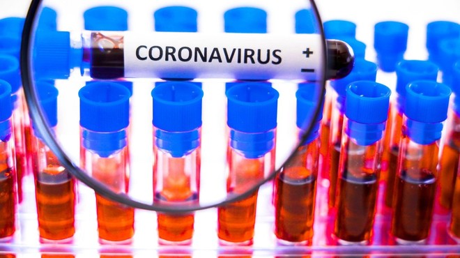 V raziskavi o razširjenosti koronavirusa pri nas so odvzeli vse vzorce (foto: profimedia)