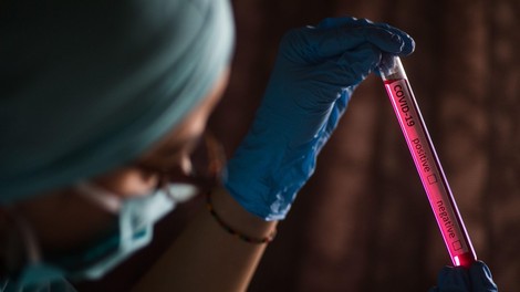 Med 500 testiranimi v soboto nobenega okuženega