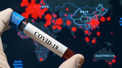Je covid-19 prebolelo tudi do 85-krat več ljudi, kot kažejo uradni zaznamki?