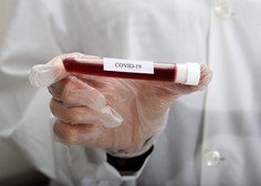 Slovence koronavirus skrbi vse manj