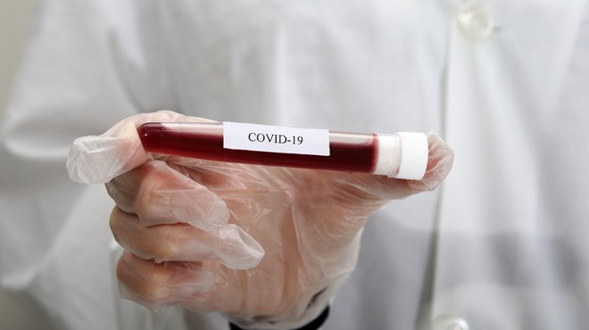 Slovence koronavirus skrbi vse manj (foto: Profimedia)