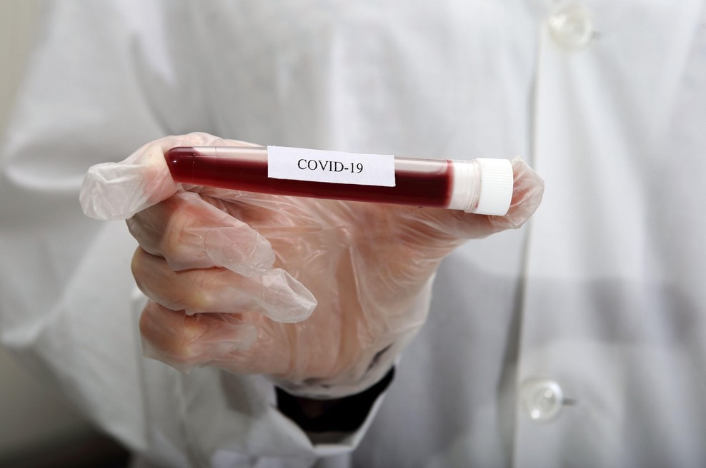 Slovence koronavirus skrbi vse manj (foto: Profimedia)