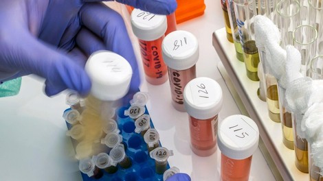 V soboto med 625 testiranimi trije okuženi, umrla je ena oseba