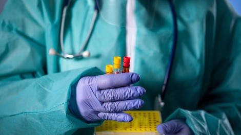 Statistika v Sloveniji: En nov primer okužbe, nobenih smrtnih žrtev