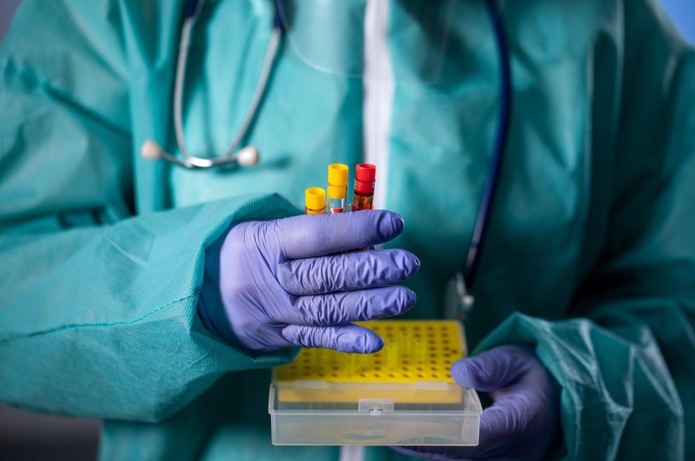 Statistika v Sloveniji: En nov primer okužbe, nobenih smrtnih žrtev (foto: Profimedia)
