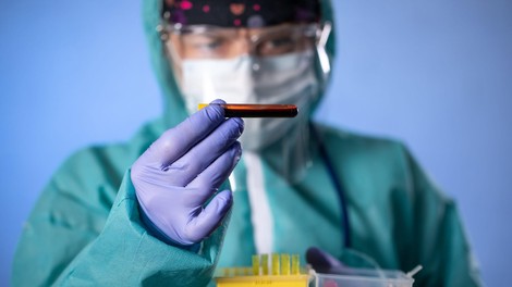 Kawasakijev sindrom lahko povezan s covidom-19