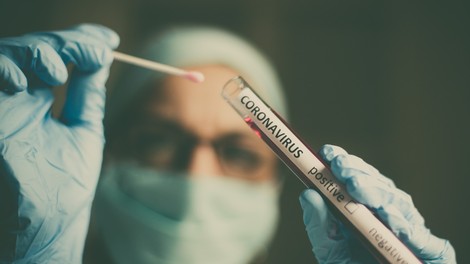 Statistika v Sloveniji: ena potrjena okužba, število hospitaliziranih pada
