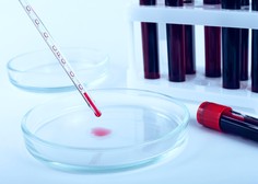 V Sloveniji so opravili 256 testiranj in potrdili eno okužbo