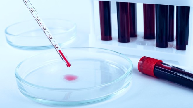 V Sloveniji so opravili 256 testiranj in potrdili eno okužbo (foto: Profimedia)