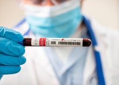 V Sloveniji dve novi okužbi s koronavirusom
