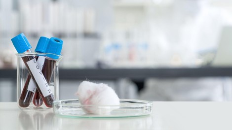 Med včerajšnjimi testi v Sloveniji dva pozitivna