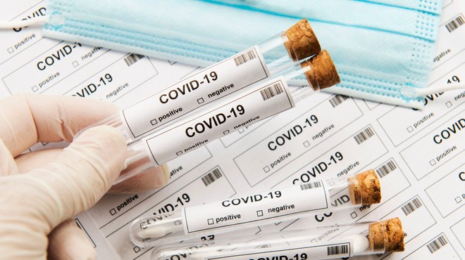 Od 211 testiranih v nedeljo brez novopotrjenih okužb (foto: Profimedia)
