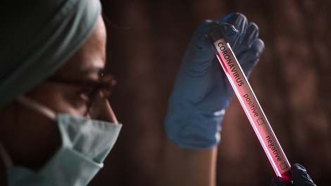 Med 767 petkovimi testi dva pozitivna, umrl ni nihče